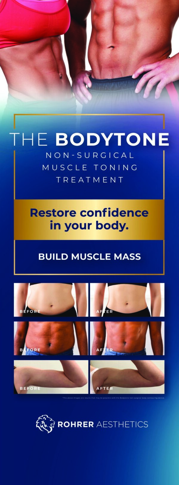 BodyTone Banner