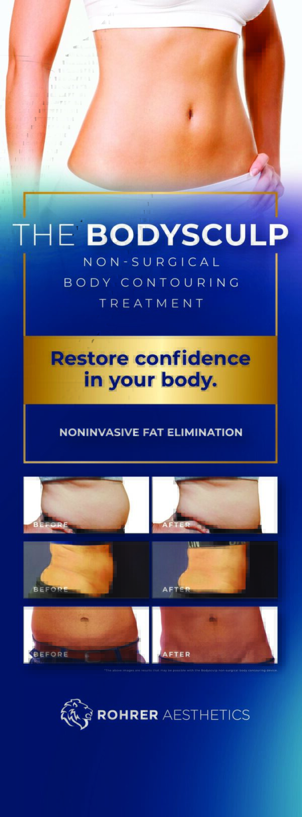 BodySculp Banner