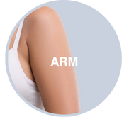 Arm